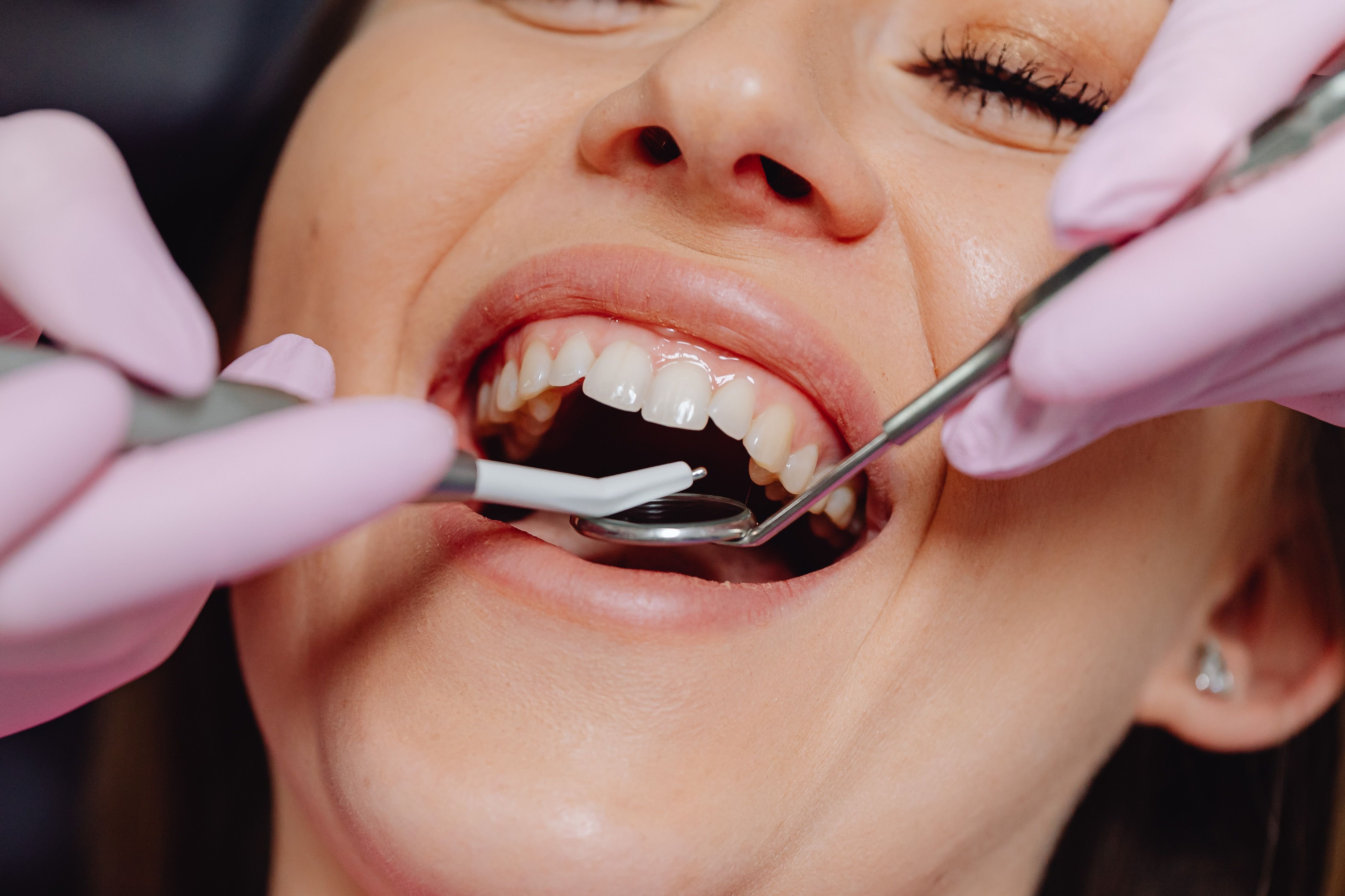 Dental Check-Up (Diş Muayenesi)