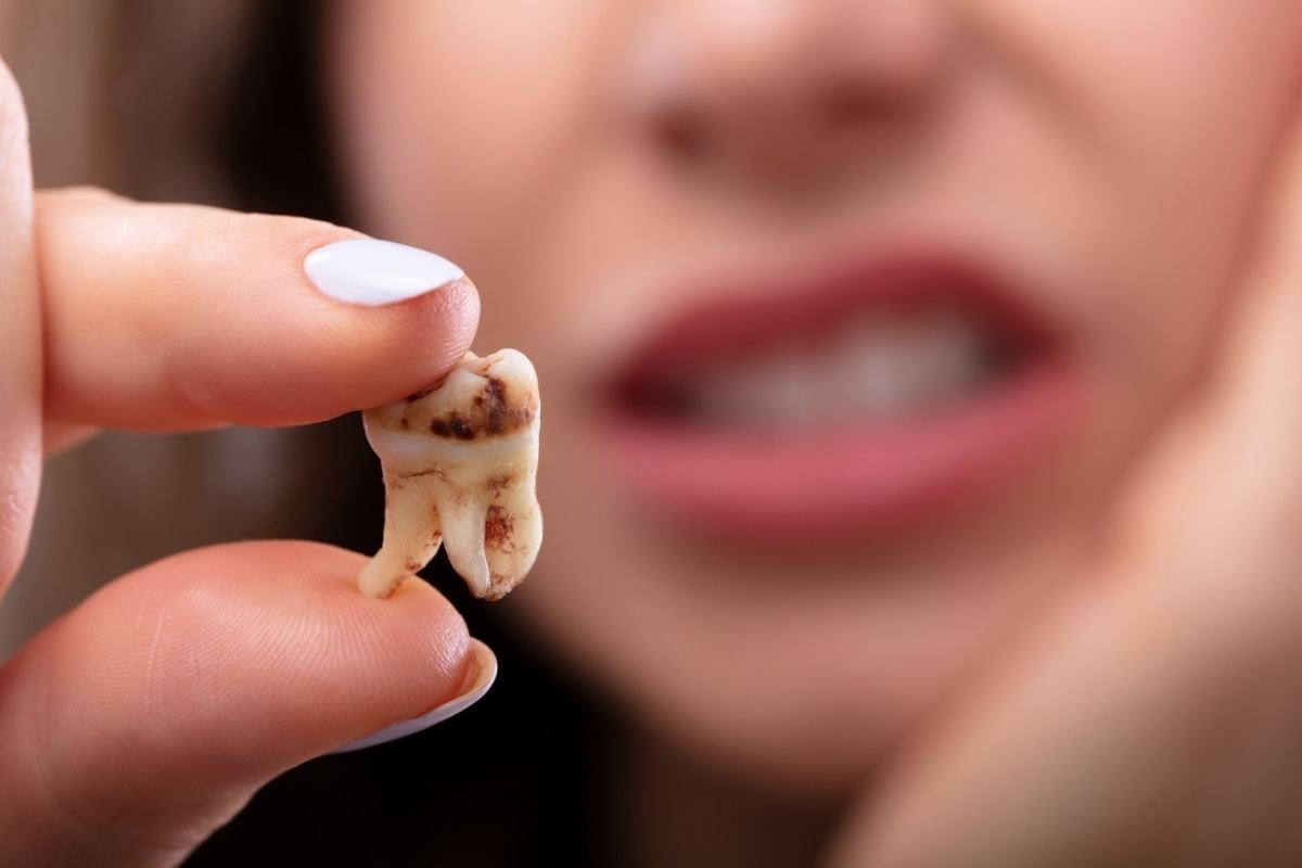 Diş Çürüğünü Önlemek İçin Nelere Dikkat Edilmeli?