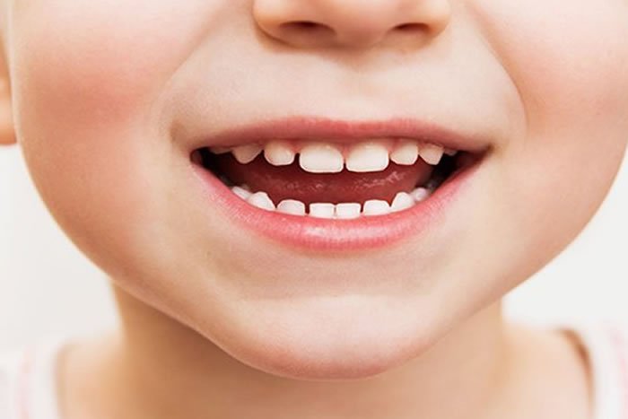 Süt Dişi Tedavileri